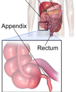 Appendix, Blinddarms