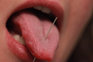Der Vorgang des Stechens eines Zungenpiercings