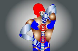 Ursachen von Rückenschmerzen im oberen Rücken