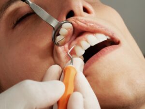 Wann sollten Sie einen Zahnarzt aufsuchen?