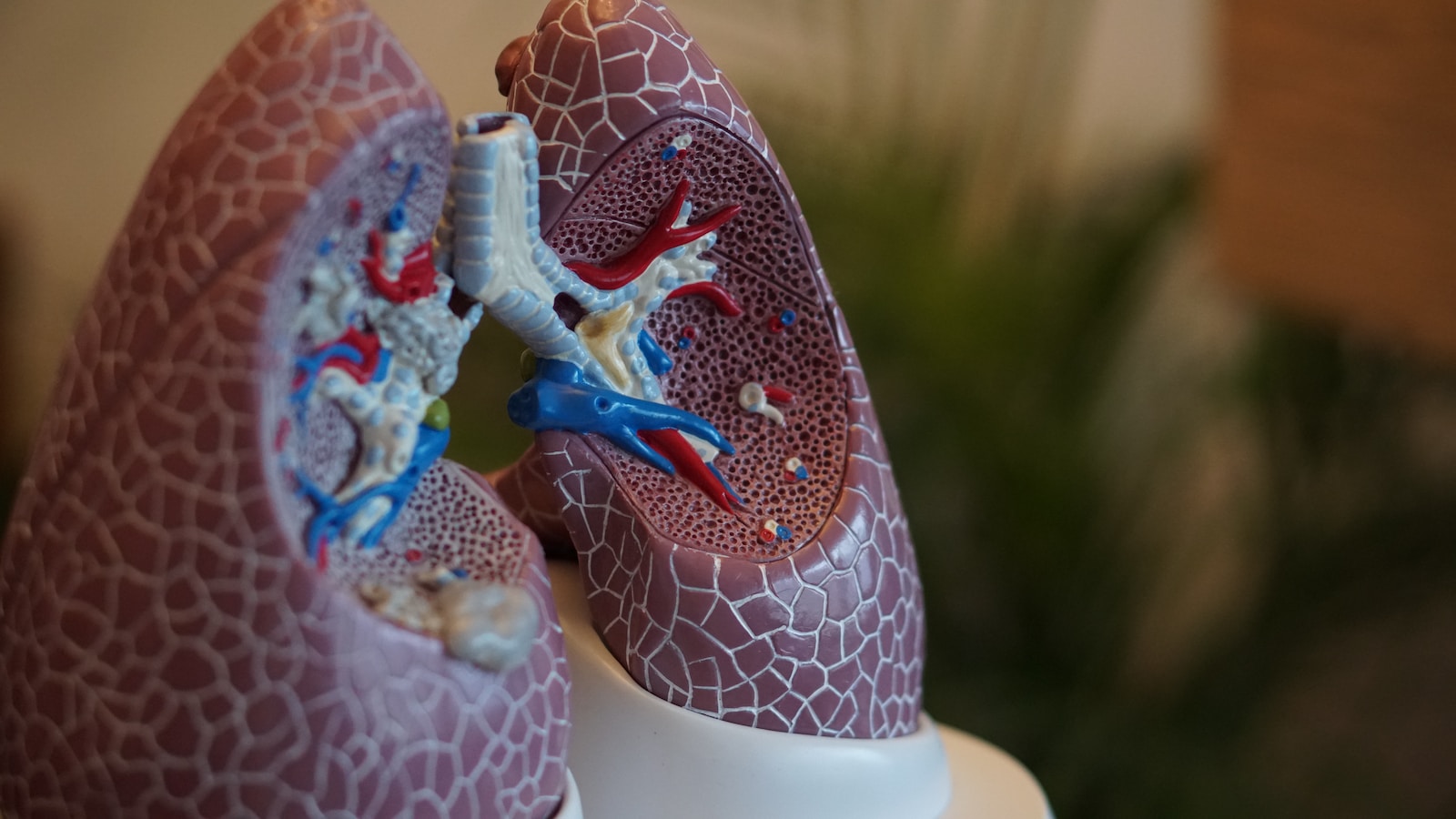 Lungenödem: Ursache für Wasser in der Lunge
