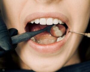 Zahnarzt: Außergewöhnliche Belastungen